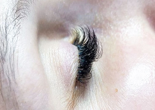 Skóra w okolicach oczu